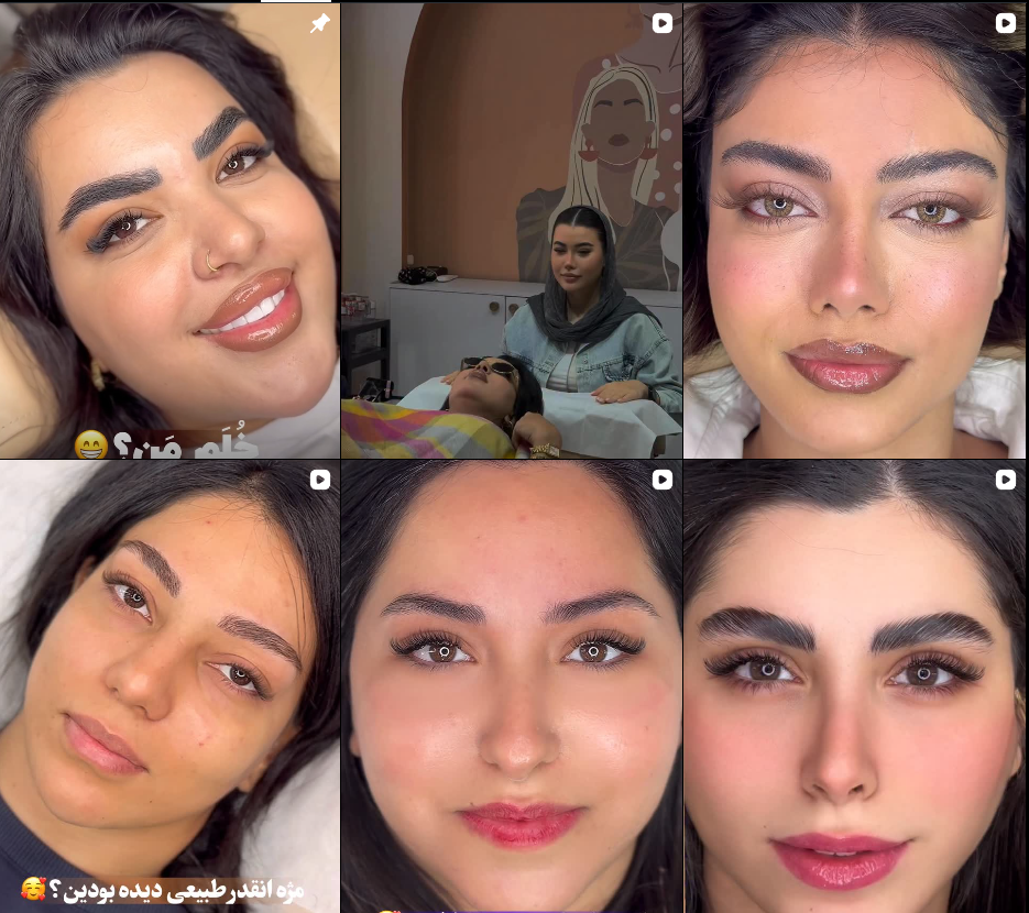 کاشت مژه مهرشهر کرج