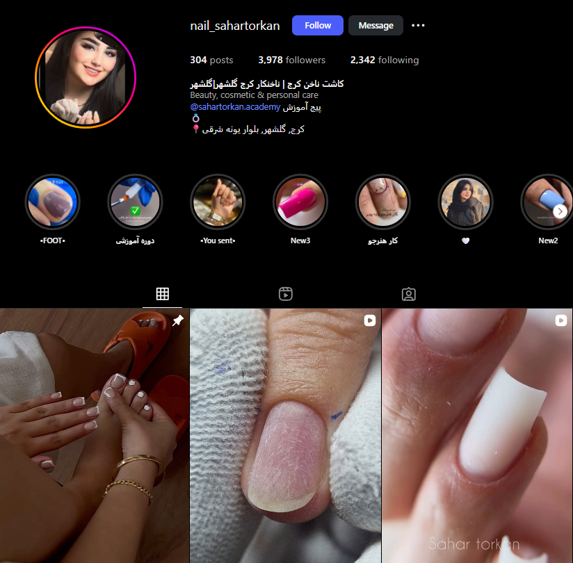 ناخن کار در گلشهر کرج