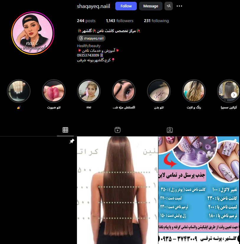 کاشت ناخن در گلشهر