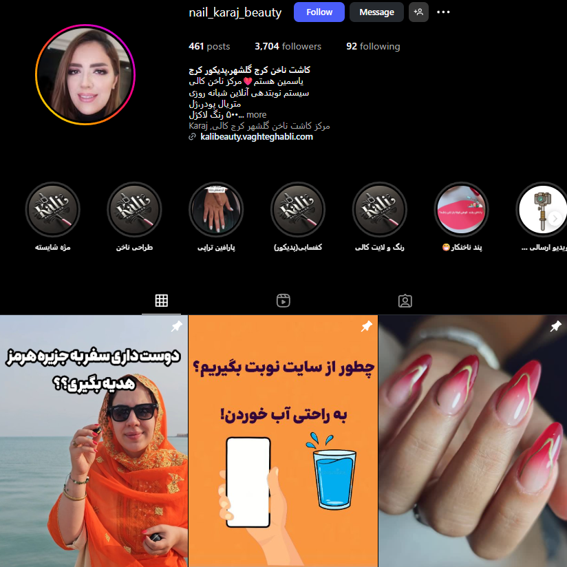 کاشت ناخن در گلشهر